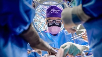 Surgeons from NYU Langone Health have performed a miraculous operation on a man named Aaron James to transplant a whole left eye and socket and a partial face. (X(formerly Twitter)/@nyulangone) Surgeons from NYU Langone Health have performed a miraculous operation on a man named Aaron James to transplant a whole left eye and socket and a partial face. (X(formerly Twitter)/@nyulangone)
