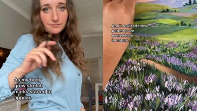 Sarah-Elaine Fritch makes art using stretch marks. (Instagram/@Sarah-Elaine Fritch) Sarah-Elaine Fritch makes art using stretch marks. (Instagram/@Sarah-Elaine Fritch)