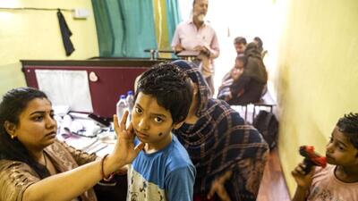 Mumbai, India - Nov. 9, 2023: Dr Shilpa Varma, the doctor who treatment to Mumps patient 9 years old Zinath Fatima at Janta Nagar, Mankhurd in Mumbai, India, on Thursday, November 9, 2023. (Photo by Satish Bate/ Hindustan Times) (Hindustan Times) Mumbai, India - Nov. 9, 2023: Dr Shilpa Varma, the doctor who treatment to Mumps patient 9 years old Zinath Fatima at Janta Nagar, Mankhurd in Mumbai, India, on Thursday, November 9, 2023. (Photo by Satish Bate/ Hindustan Times) (Hindustan Times)