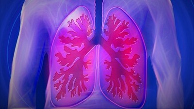 Risk of high lung cancer cases among naval veterans connected to asbestos: Study (Image by kalhh from Pixabay ) Risk of high lung cancer cases among naval veterans connected to asbestos: Study (Image by kalhh from Pixabay )