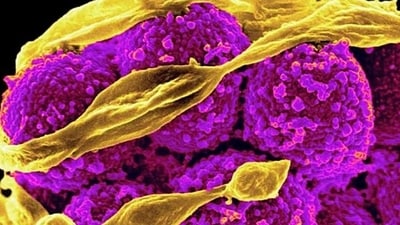 Infections caused by methicillin-resistant Staphylococcus aureus bacteria, known as MRSA, are particularly difficult to treat (picture-alliance/BSIP/NIAID) Infections caused by methicillin-resistant Staphylococcus aureus bacteria, known as MRSA, are particularly difficult to treat (picture-alliance/BSIP/NIAID)