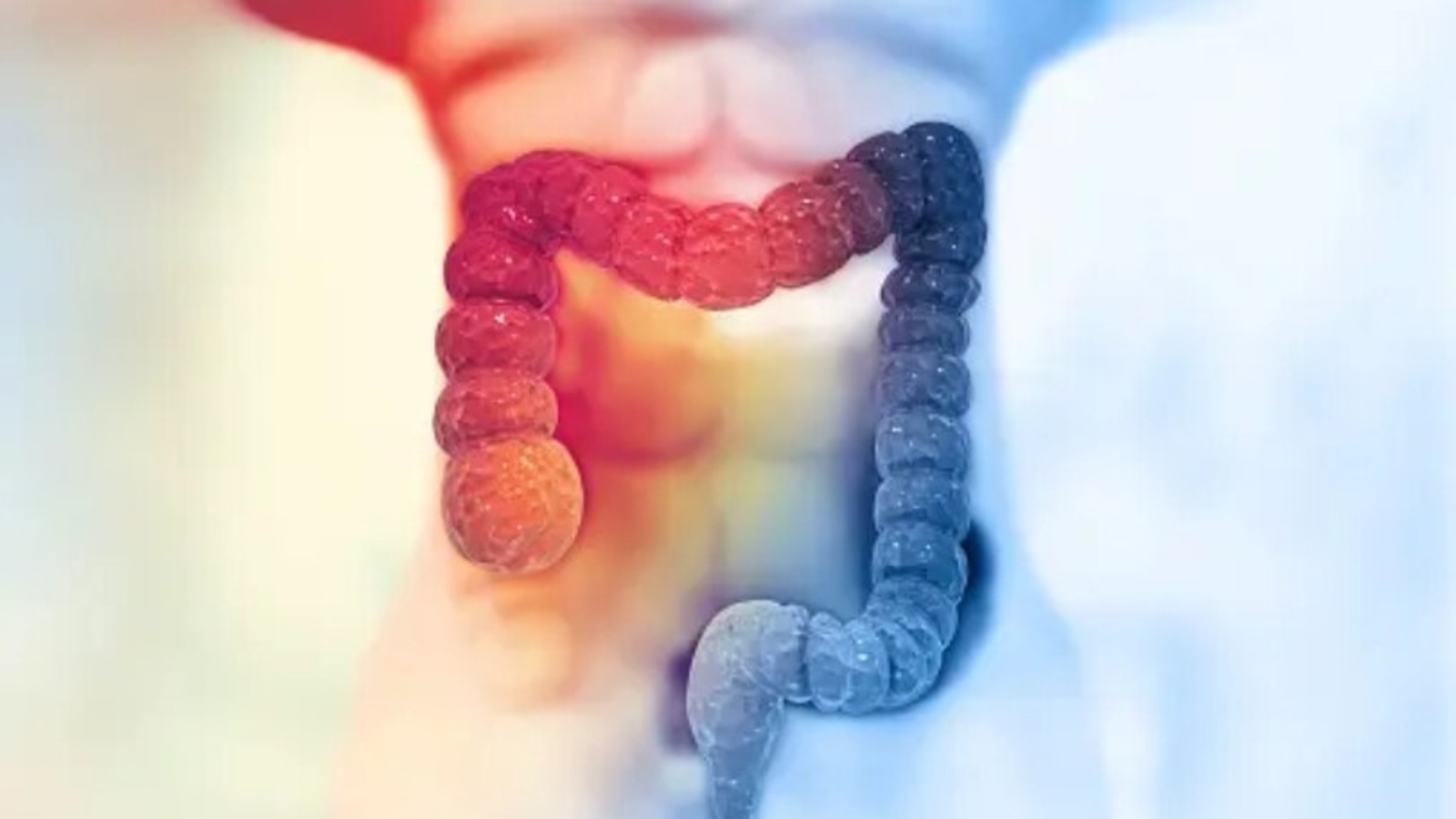 Blood transfusion requirements reduced with iron infusion prior to bowel surgery | Health - Vimarsana News