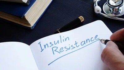 Insulin resistance: Increased cortisol levels lead to consistently high blood sugar, promoting fat storage and inducing insulin resistance. (Unsplash) Insulin resistance: Increased cortisol levels lead to consistently high blood sugar, promoting fat storage and inducing insulin resistance. (Unsplash)