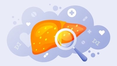 Robotic liver transplant: When and who should do it? (Freepik) Robotic liver transplant: When and who should do it? (Freepik)