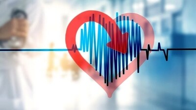 Atrial fibrillation involves the smaller chambers of the heart fibrillating instead of contracting normally, leading to a rapid heartbeat. (Pixabay) Atrial fibrillation involves the smaller chambers of the heart fibrillating instead of contracting normally, leading to a rapid heartbeat. (Pixabay)