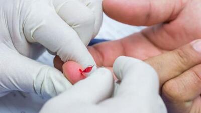 The novel test kit is India’s first multidrug-resistant TB test and is also integrated into the Ni-kshay portal. (REPRESENTATIVE PHOTO)