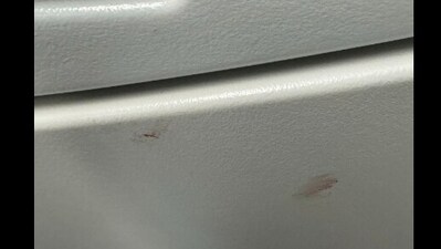 Blood stains the seat of a flight. (X/@birgitomo ) Blood stains the seat of a flight. (X/@birgitomo )