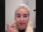 Amanda Bynes has revealed getting plastic surgery on her eyelids