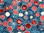 Japan Mpox Death: The virus was until recently known as monkeypox. 