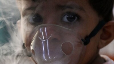 5. Pneumonia: Numerous pathogens, such as bacteria, viruses, or fungus, can cause pneumonia, which causes inflammation of the lung's air sacs. Cough, fever, dyspnoea, and chest pain are among the symptoms.&nbsp; (AFP)