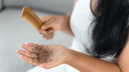 Hair loss can be a major sign of Vitamin D deficiency in the body. It is important to maintain optimum amount of Vitamin D in the body for healthy hair.&nbsp;(Unsplash)