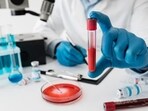 In India, sepsis cases have been estimated to be 11.3 million, with 2.9 million deaths in 2017, as per CHEST Journal