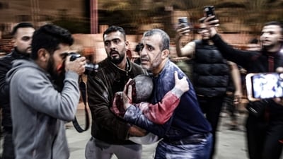 Israel-Hamas War: A man carrying a child, injured following Israeli bombardment, arrives to Nasser hospital in Khan Yunis in the southern Gaza Strip. (AFP) Israel-Hamas War: A man carrying a child, injured following Israeli bombardment, arrives to Nasser hospital in Khan Yunis in the southern Gaza Strip. (AFP)