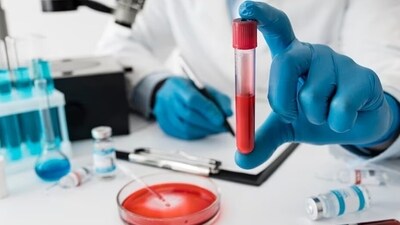 In India, sepsis cases have been estimated to be 11.3 million, with 2.9 million deaths in 2017, as per CHEST Journal (Freepik) In India, sepsis cases have been estimated to be 11.3 million, with 2.9 million deaths in 2017, as per CHEST Journal (Freepik)