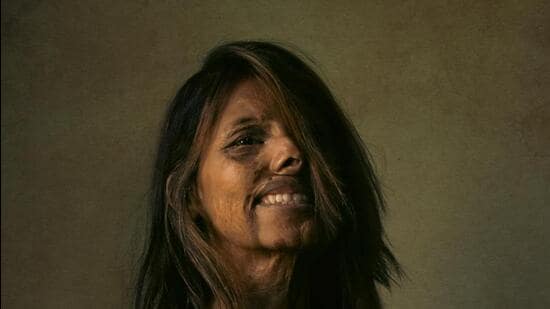 Anmol Rodriguez was only two months old when her father threw acid on her and her mother. Her mother died, but Anmol survived, blinded in one eye (Photo: budapestfotoawards.com)