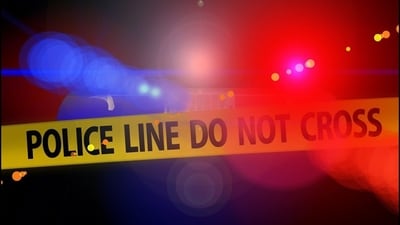 After police arrived, they discovered a second leg (Pixabay - representational image) After police arrived, they discovered a second leg (Pixabay - representational image)