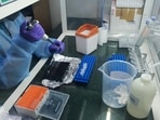 A file photo of a lab technician using a dropper during COVID-19 RT PCR testing at a laboratory in Noida. A file photo of a lab technician using a dropper during COVID-19 RT PCR testing at a laboratory in Noida.