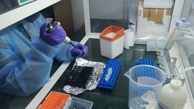 A file photo of a lab technician using a dropper during COVID-19 RT PCR testing at a laboratory in Noida. (Bloomberg) A file photo of a lab technician using a dropper during COVID-19 RT PCR testing at a laboratory in Noida. (Bloomberg)