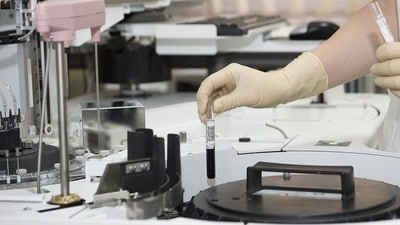 The new variant has led to hospitalisations across the country, and has proved fatal in some cases (Pixabay - representational image) The new variant has led to hospitalisations across the country, and has proved fatal in some cases (Pixabay - representational image)