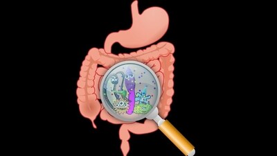Want to age gracefully? Take charge of your gut microbiota with these tips to support healthy ageing (Image by OpenClipart-Vectors from Pixabay ) Want to age gracefully? Take charge of your gut microbiota with these tips to support healthy ageing (Image by OpenClipart-Vectors from Pixabay )