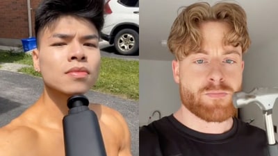 The TikTok-approved beauty hack involves intentionally fracturing facial bones to achieve altered facial features, such as enlarged cheekbones or a more prominent chin. The TikTok-approved beauty hack involves intentionally fracturing facial bones to achieve altered facial features, such as enlarged cheekbones or a more prominent chin.