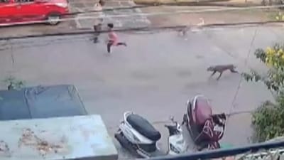 6-year-old boy attacked by stray dogs in Andhra Pradesh's Guntur 6-year-old boy attacked by stray dogs in Andhra Pradesh's Guntur