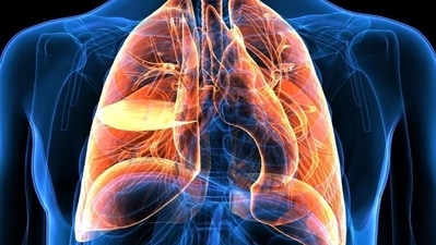 3. Lung diseases: The origin of air pollution—stemming from vehicle emissions, industrial processes, and other sources—is associated with numerous potentially life-threatening health issues. Studies indicate that air pollution, particularly ozone, which is on the rise due to climate change, can accelerate lung diseases as severely as smoking a pack of cigarettes. (Shutterstock) 3. Lung diseases: The origin of air pollution—stemming from vehicle emissions, industrial processes, and other sources—is associated with numerous potentially life-threatening health issues. Studies indicate that air pollution, particularly ozone, which is on the rise due to climate change, can accelerate lung diseases as severely as smoking a pack of cigarettes. (Shutterstock)