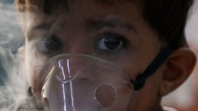 4. Lung damage in unborn child: Exposure to elevated pollution levels during pregnancy, regardless of personal asthma history, heightens the likelihood of asthma development in the baby. Additionally, air pollution escalates the risk of lung infections like bronchitis and pneumonia. Evidence suggests that inhaling particulate matter (PM) contributes to the onset of lung cancer. (Photo by Arun SANKAR / AFP) / TO GO WITH: India-pollution-health-children, FOCUS by Abhaya Srivastava (AFP) 4. Lung damage in unborn child: Exposure to elevated pollution levels during pregnancy, regardless of personal asthma history, heightens the likelihood of asthma development in the baby. Additionally, air pollution escalates the risk of lung infections like bronchitis and pneumonia. Evidence suggests that inhaling particulate matter (PM) contributes to the onset of lung cancer. (Photo by Arun SANKAR / AFP) / TO GO WITH: India-pollution-health-children, FOCUS by Abhaya Srivastava (AFP)