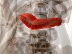 Pancreatic cancer: Causes, symptoms, treatment and prevention tips 