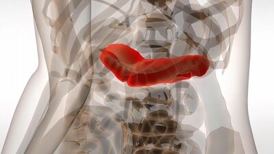 Pancreatic cancer: Causes, symptoms, treatment and prevention tips (Photo by Ersin Arslan/Zoonar/picture alliance) Pancreatic cancer: Causes, symptoms, treatment and prevention tips (Photo by Ersin Arslan/Zoonar/picture alliance)