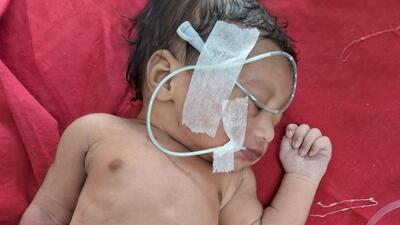 One-day old baby girl dumped in toilet bowl, rescued