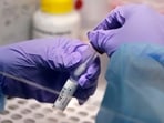 Karnataka reported 163 fresh cases of  Covid-19 on Friday, down from the 240 cases it recorded the day before. (AP)