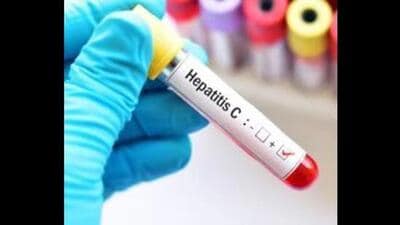 Hepatitis C virus spreads through exposure to an infected person’s blood and there is no vaccine against it. (HT File)