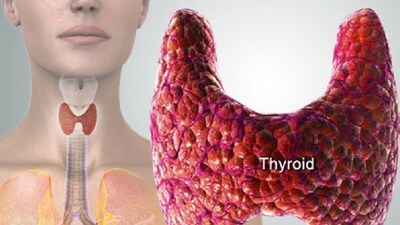 Thyroid troubles: The silent impact on your heart and what you need to know (Photo by Twitter/WebMD) Thyroid troubles: The silent impact on your heart and what you need to know (Photo by Twitter/WebMD)