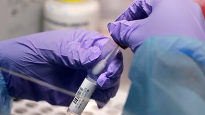 As the WHO puts it, it’s to “enable early cross-cutting R&D preparedness that is also relevant” for an unknown disease. (Representational)