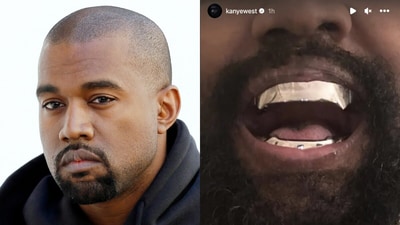 Rapper flaunts pricey Titanium dentures on Instagram (AFP/Kanye West/Instagram) Rapper flaunts pricey Titanium dentures on Instagram (AFP/Kanye West/Instagram)
