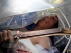 The image shows a guitarist playing music during his brain tumour surgery. The image shows a guitarist playing music during his brain tumour surgery.