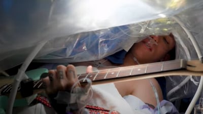 The image shows a guitarist playing music during his brain tumour surgery. (YouTube/@SylvesterCancer) The image shows a guitarist playing music during his brain tumour surgery. (YouTube/@SylvesterCancer)