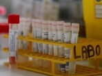 The government has recently taken several steps to promote the medtech sector.