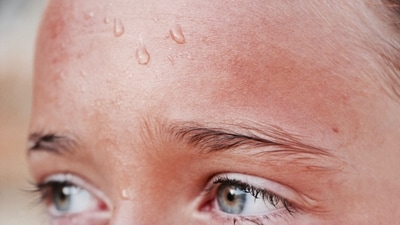 The girl has a staph infection and is currently receiving experimental treatment. (Representational Image/Unsplash) The girl has a staph infection and is currently receiving experimental treatment. (Representational Image/Unsplash)