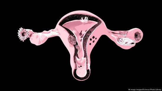 Women exposed to toxic metals might experience earlier ageing of ovaries: Study (imago images/Science Photo Library)
