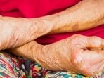 World Leprosy Day 2024: Date, history, significance(File/Representative Photo)