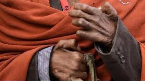 Uttar Pradesh has 9,846 identified leprosy patients who are under treatment according to data updated till December 2023. (For Representation)