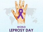 World Leprosy Day 2024(Photo by Twitter/skinskapharma)