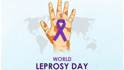 World Leprosy Day 2024 (Photo by Twitter/skinskapharma) World Leprosy Day 2024 (Photo by Twitter/skinskapharma)