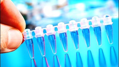 Cancer cell fingerprints could hasten diagnosis in kids. (Shutterstock) Cancer cell fingerprints could hasten diagnosis in kids. (Shutterstock)