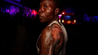 A resident who suffered burns on his back, stands near the scene of an explosion at a makeshift gas cylinder refilling depot in Mradi estate, Embakasi district, in Nairobi, Kenya. (REUTERS)