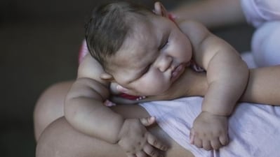 Heart defects to neural tube issues: Types of birth defects and treatment (File Photo by REUTERS) Heart defects to neural tube issues: Types of birth defects and treatment (File Photo by REUTERS)