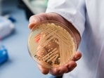 Washington State reports four cases of Candida auris Washington State reports four cases of Candida auris