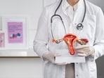 Advanced-stage cervical cancer may present with various signs and symptoms, indicating the disease's progression. Advanced-stage cervical cancer may present with various signs and symptoms, indicating the disease's progression.